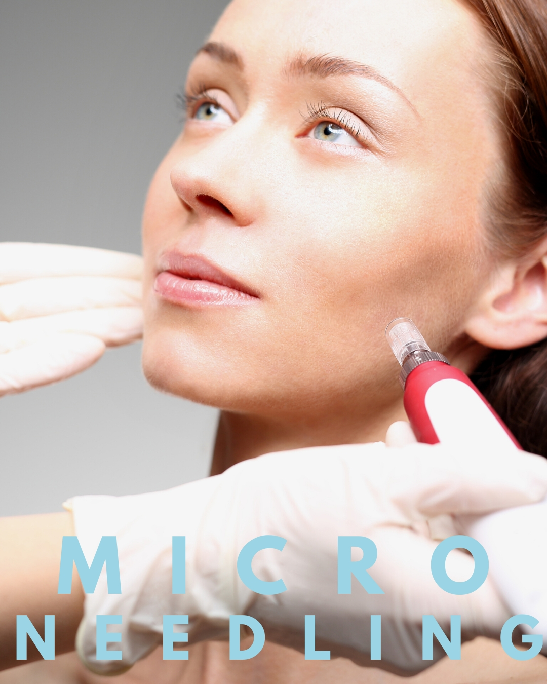 SkinPen Microneedling treatment at Auveau Aesthetics in West Lake Hills
