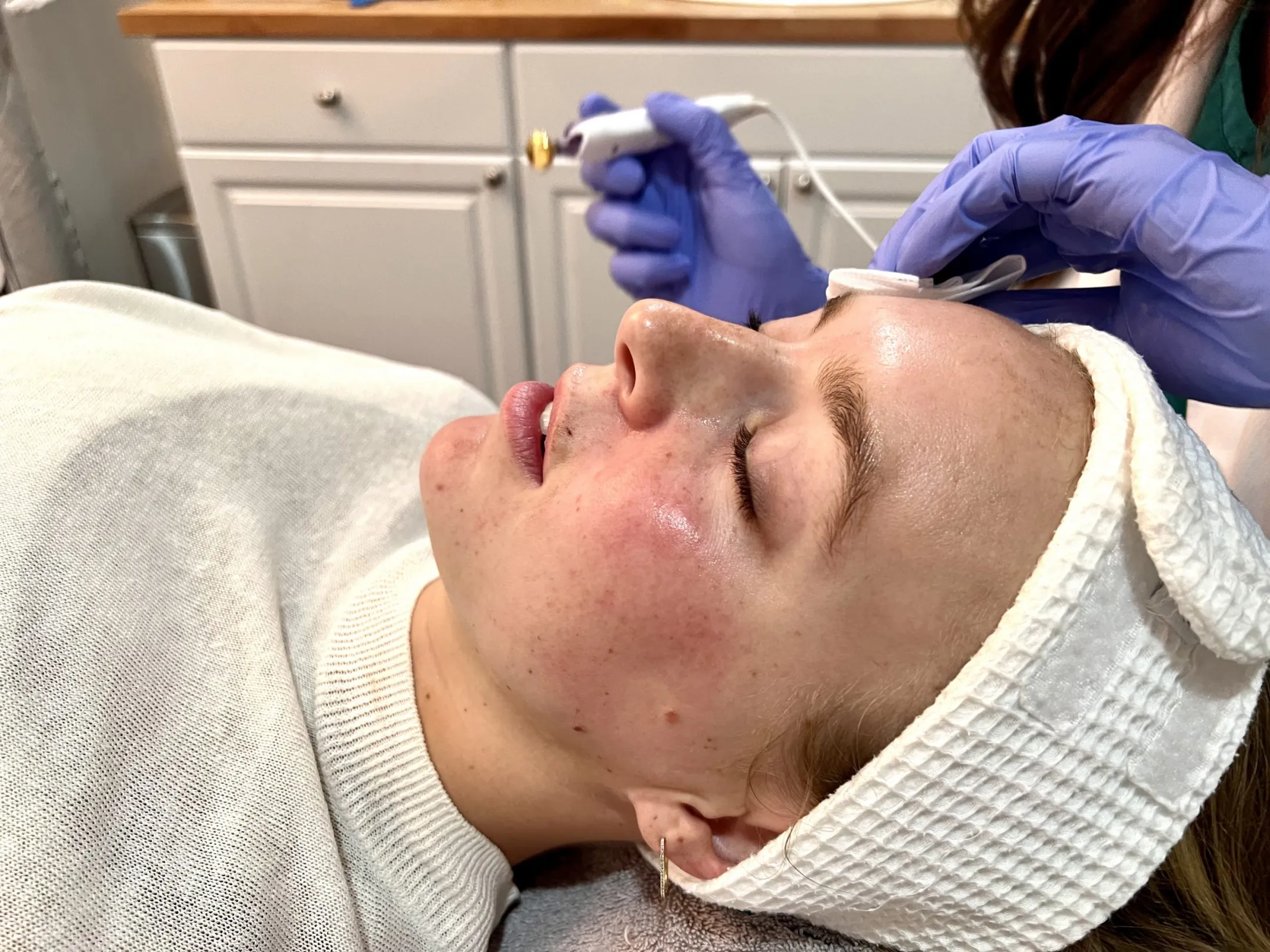 PhotoReady Facial treatment at Auveau Aesthetics in West Lake Hills
