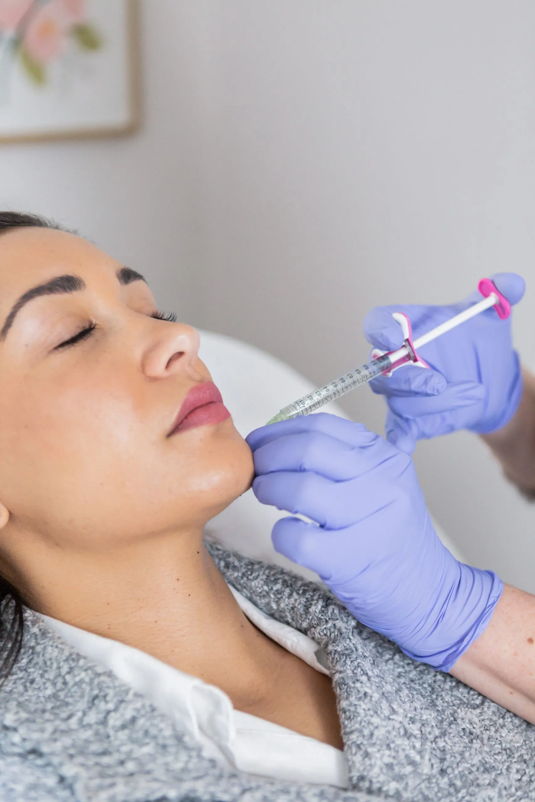 Restylane dermal filler treatment at Auveau Aesthetics in West Lake Hills